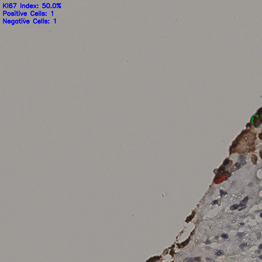 slice_10_45_x8960_y40320.png