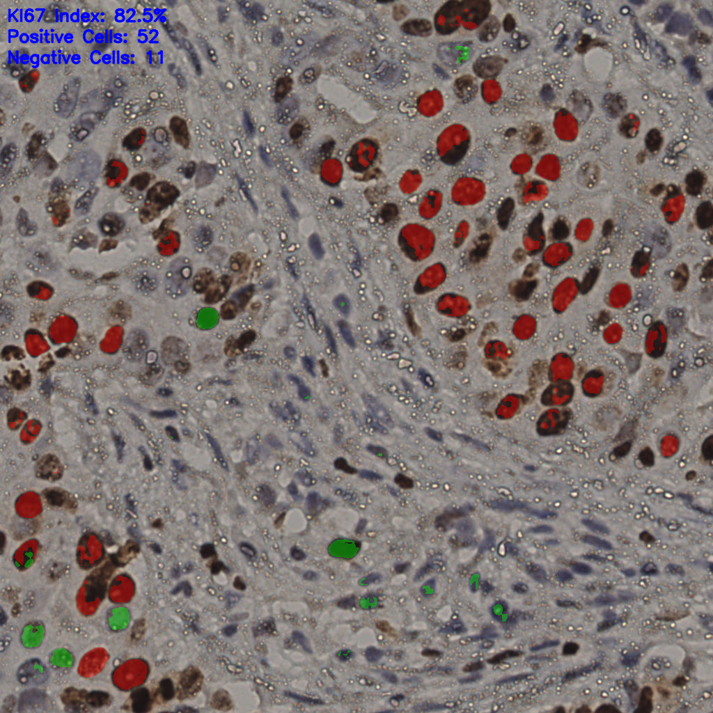 slice_10_56_x8960_y50176.png
