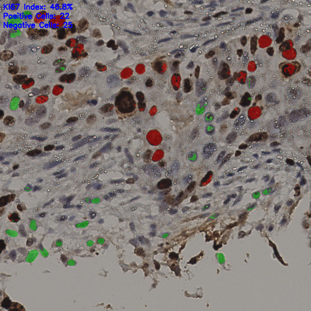 slice_10_57_x8960_y51072.png