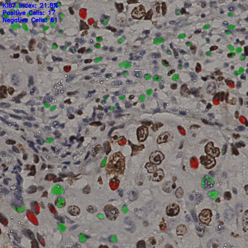 slice_11_48_x9856_y43008.png