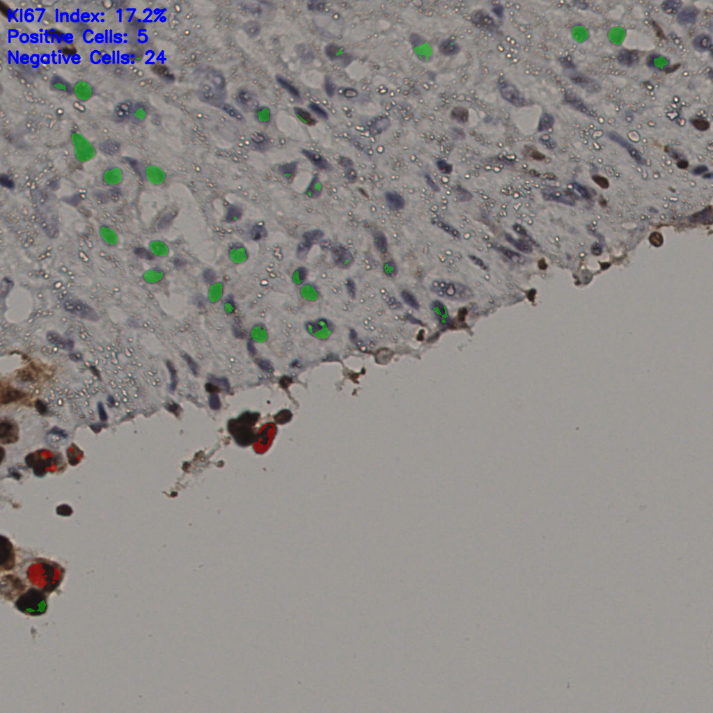 slice_12_57_x10752_y51072.png