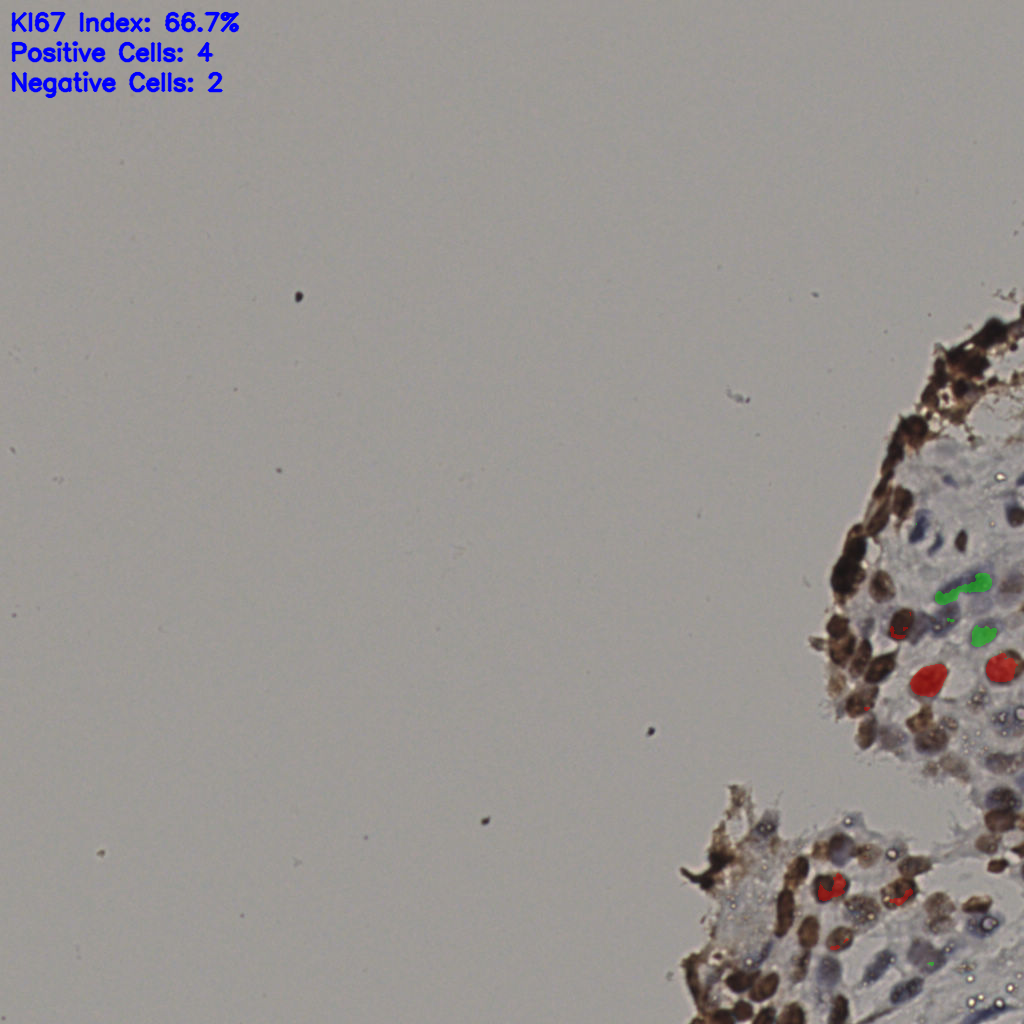 slice_13_40_x11648_y35840.png