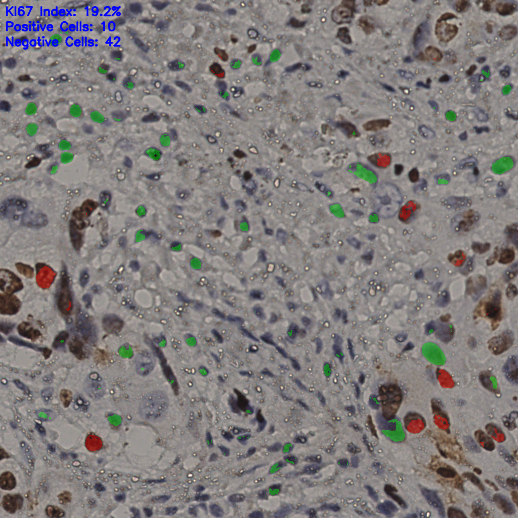 slice_13_45_x11648_y40320.png
