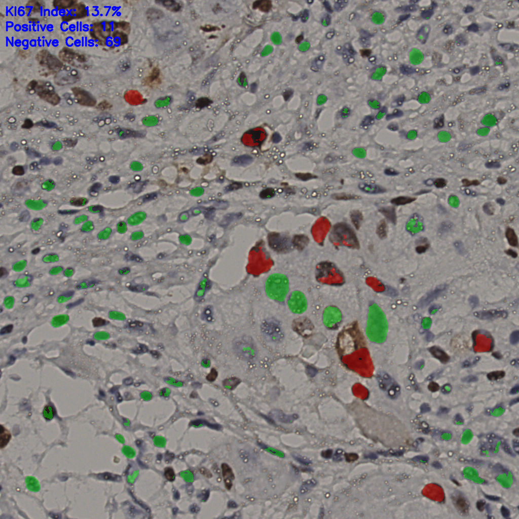 slice_13_47_x11648_y42112.png