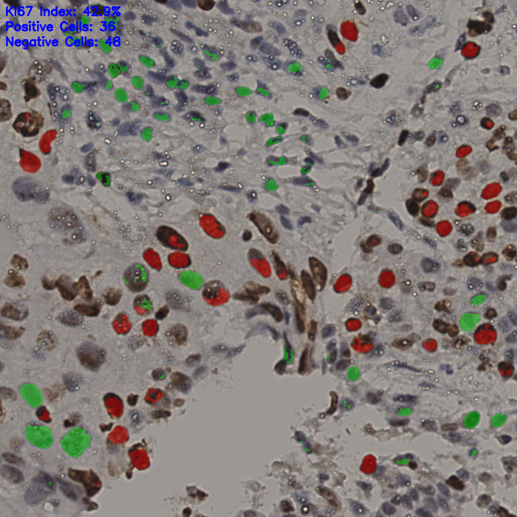 slice_13_50_x11648_y44800.png
