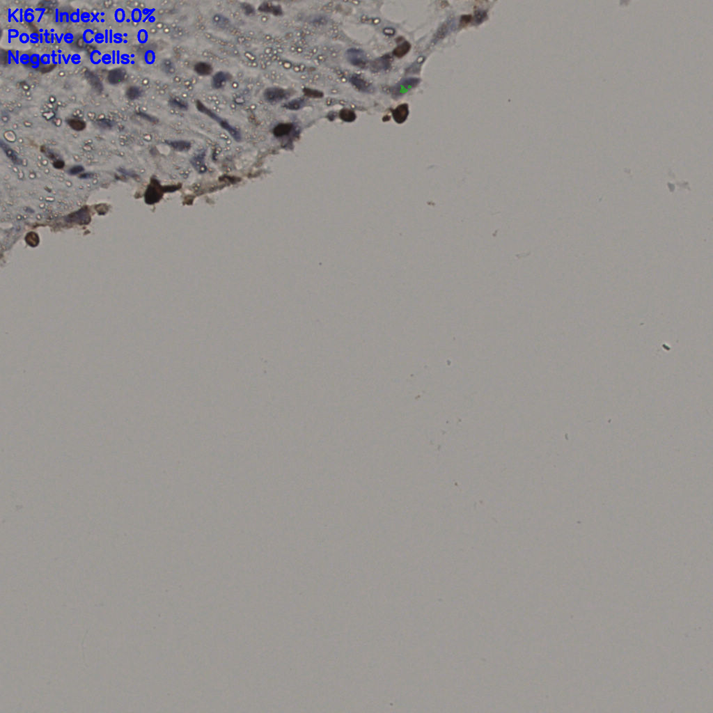 slice_13_57_x11648_y51072.png