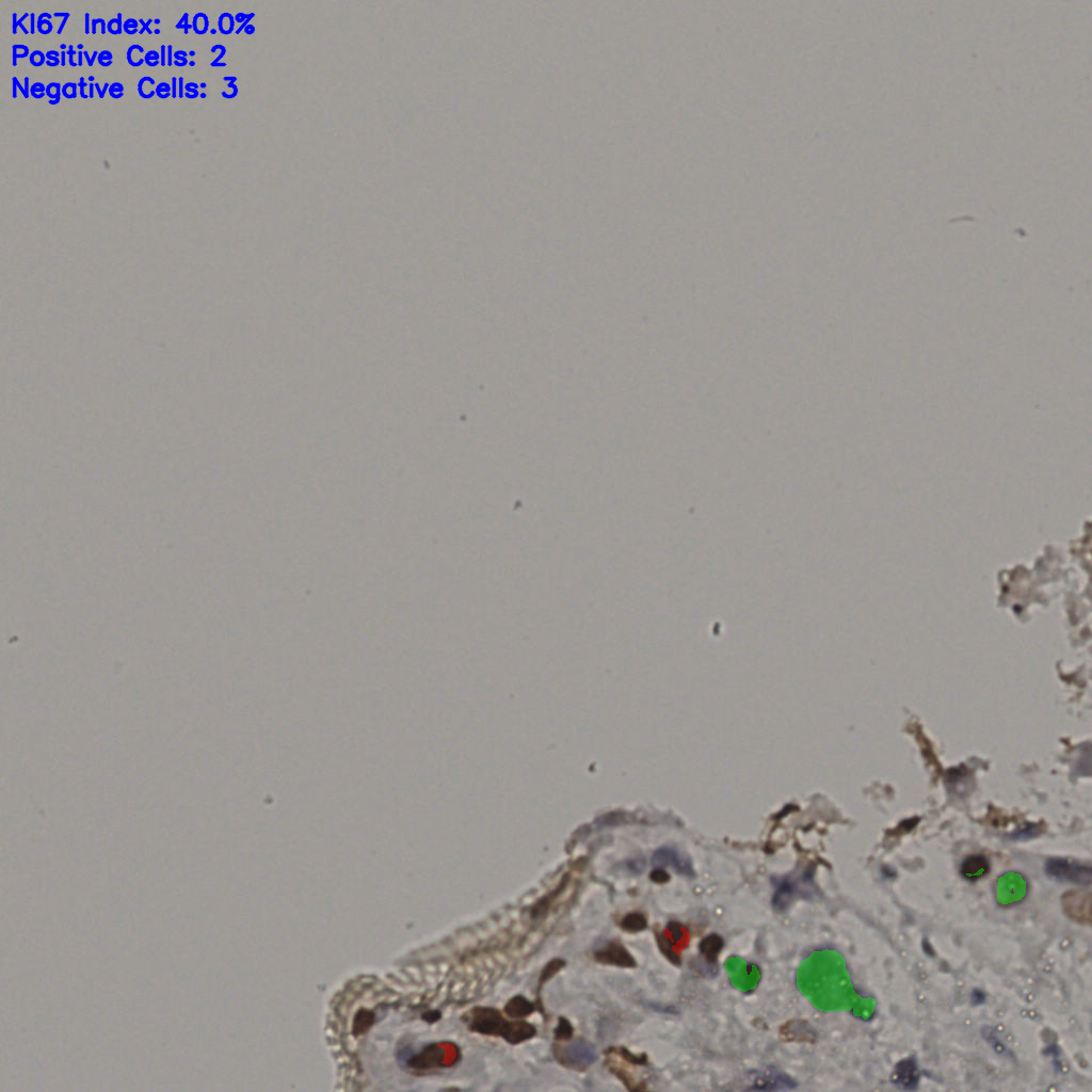 slice_14_39_x12544_y34944.png