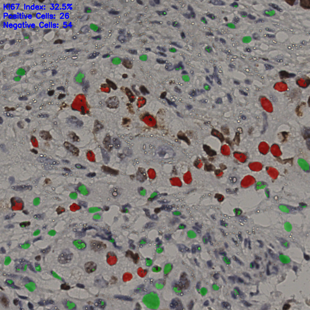 slice_14_47_x12544_y42112.png