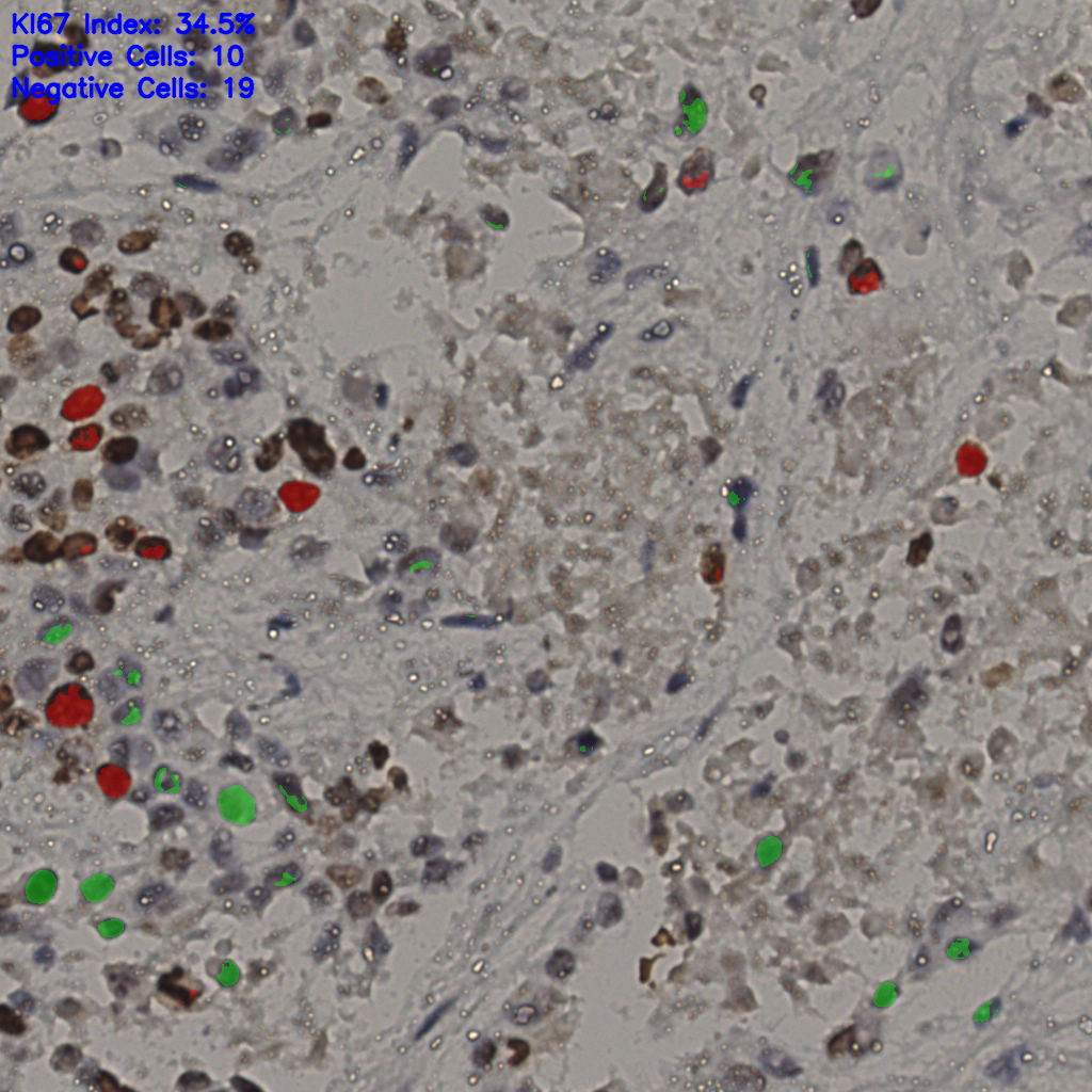 slice_14_50_x12544_y44800.png