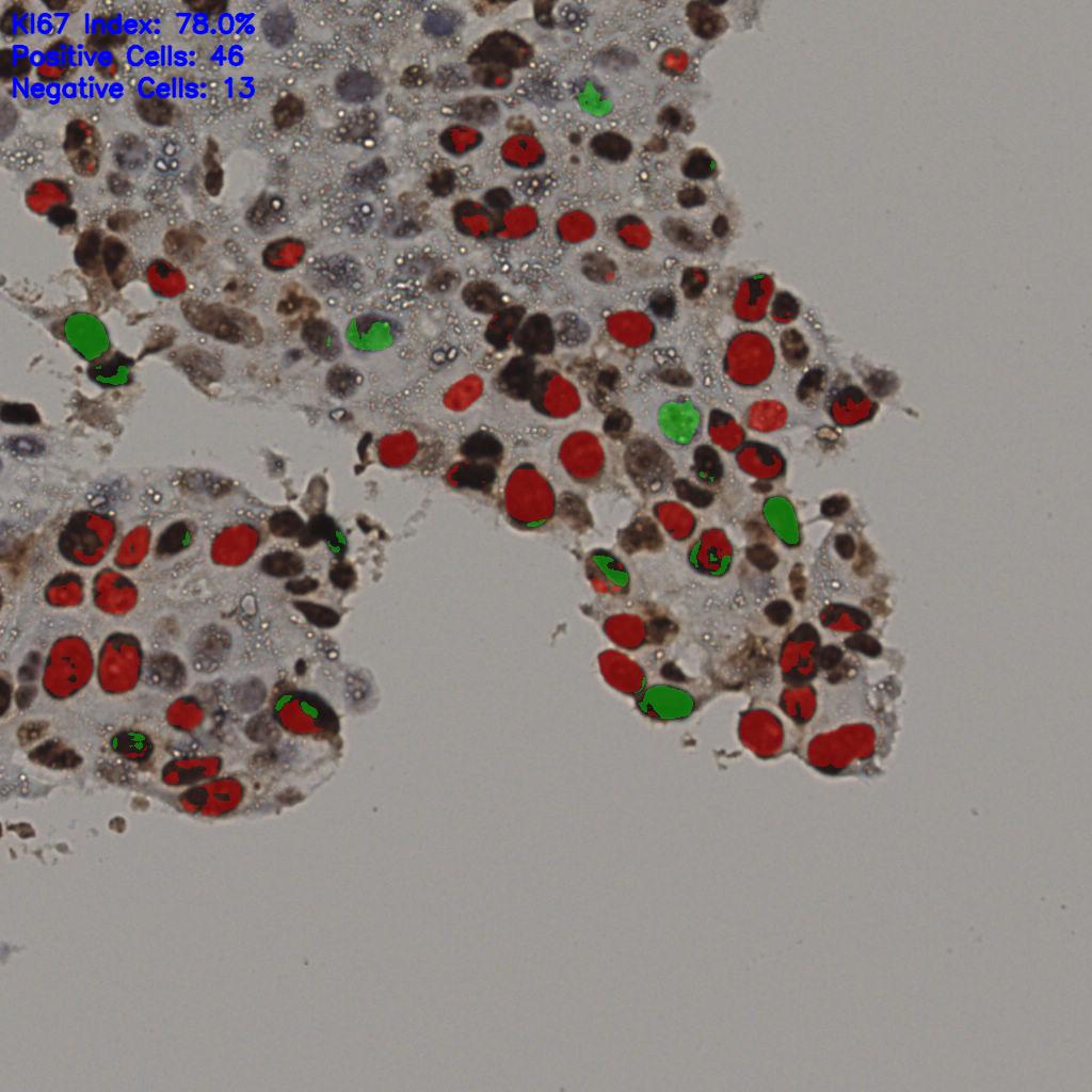 slice_14_56_x12544_y50176.png