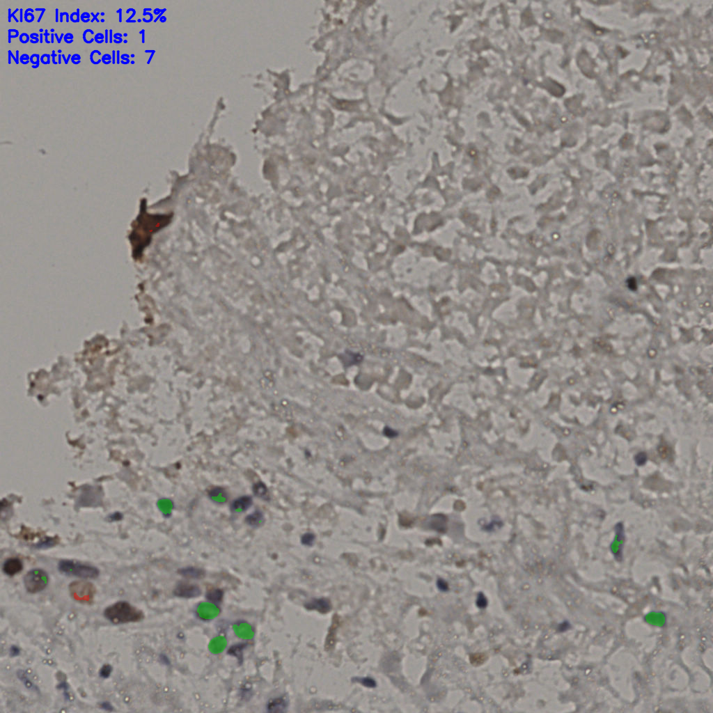 slice_15_39_x13440_y34944.png