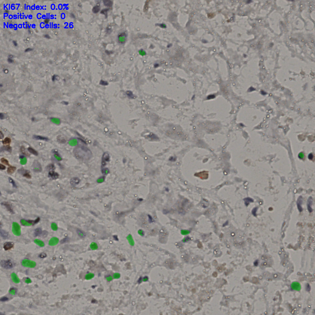 slice_15_40_x13440_y35840.png