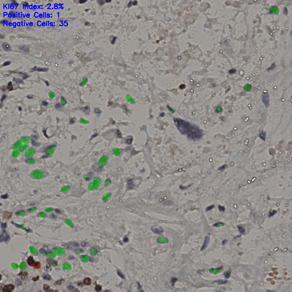 slice_15_41_x13440_y36736.png