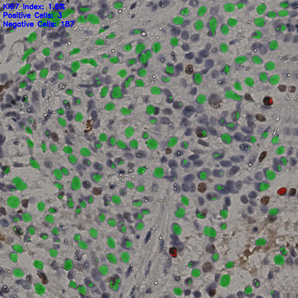 slice_15_43_x13440_y38528.png