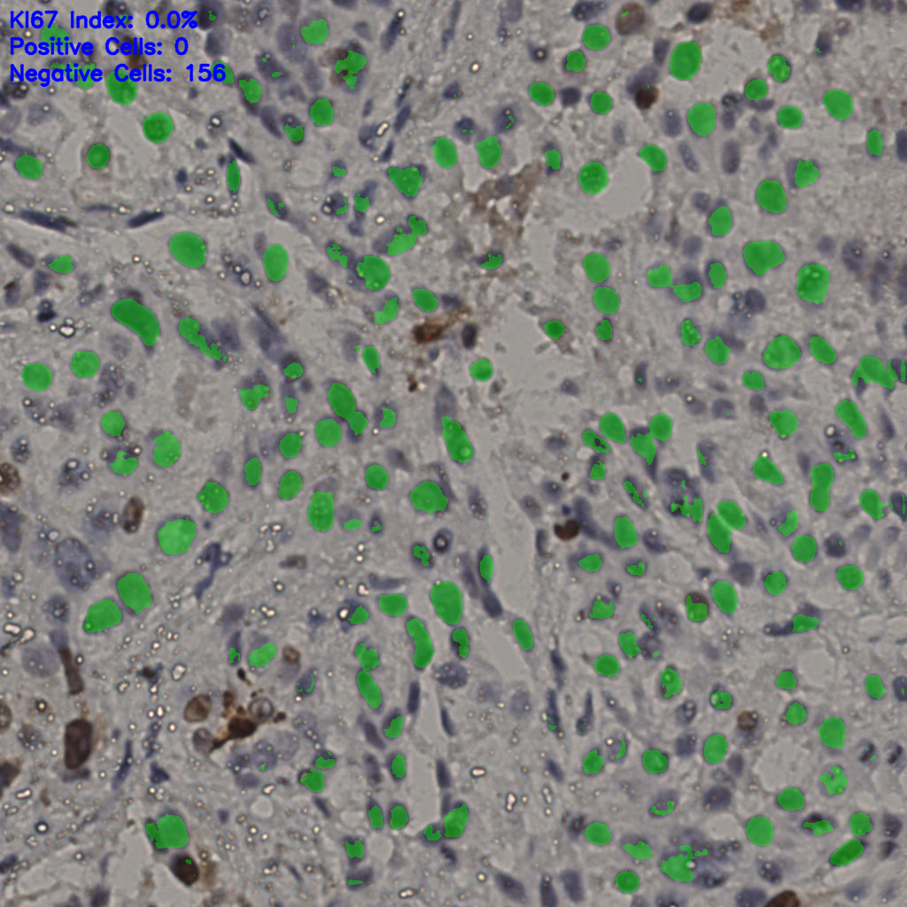 slice_15_44_x13440_y39424.png