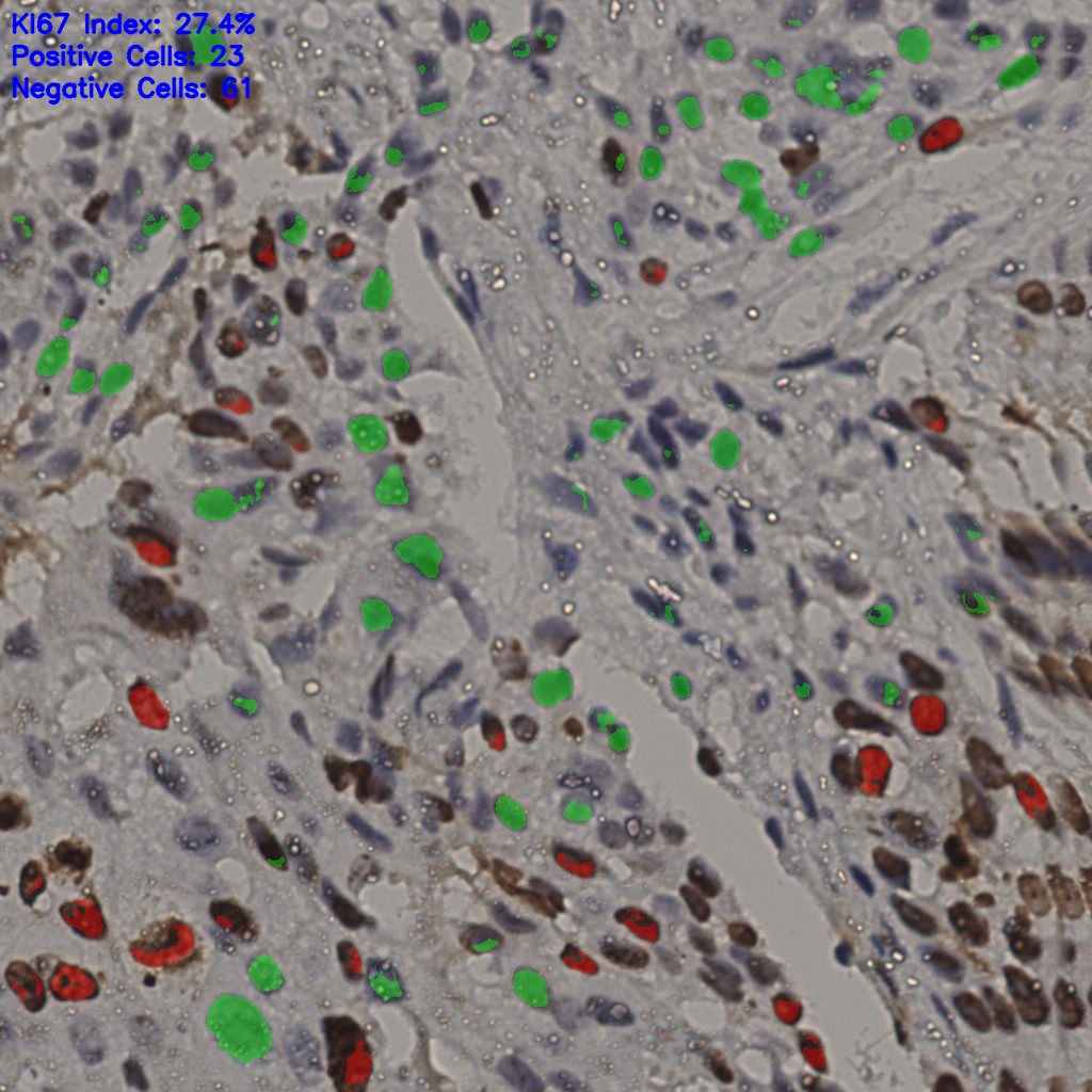 slice_15_45_x13440_y40320.png
