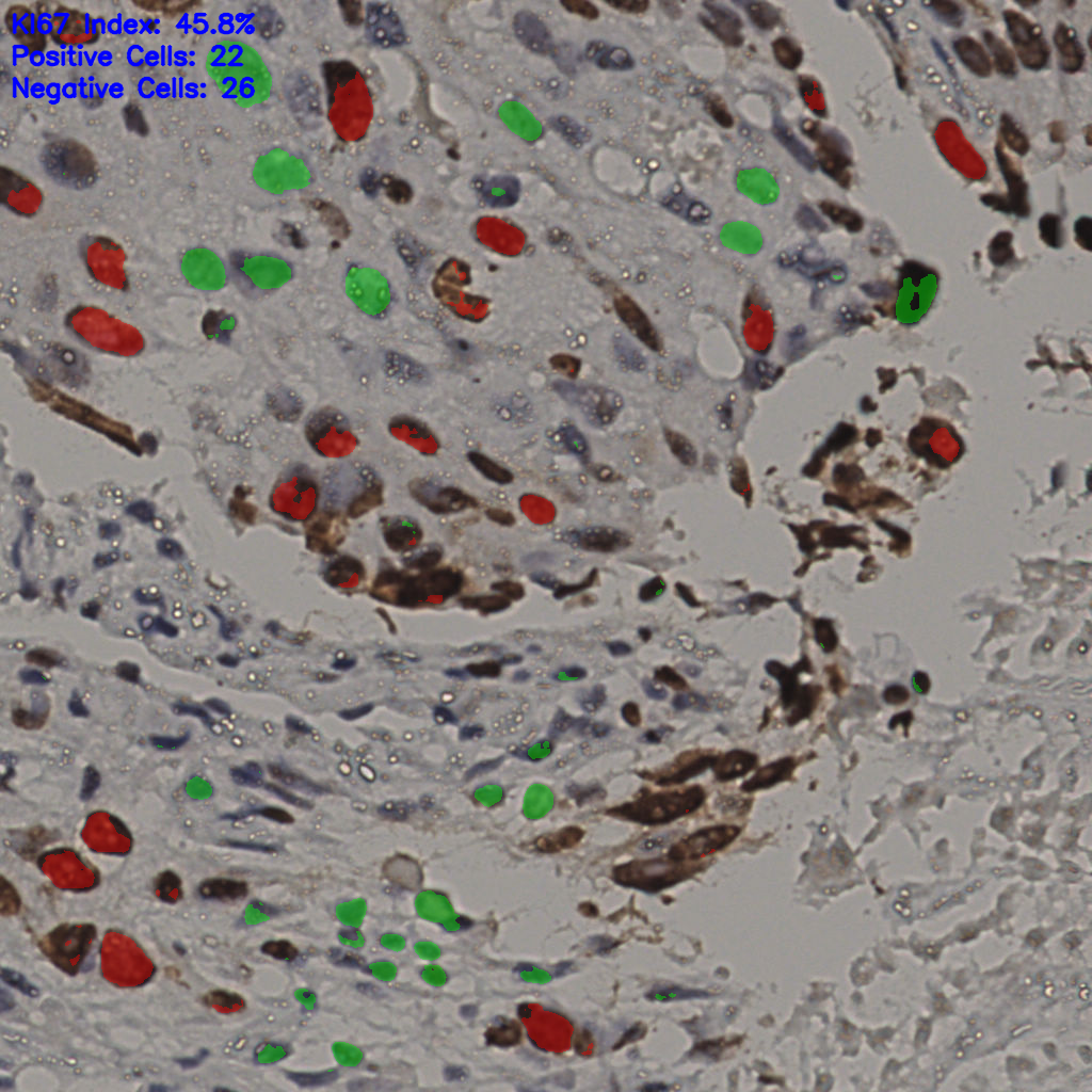 slice_15_46_x13440_y41216.png