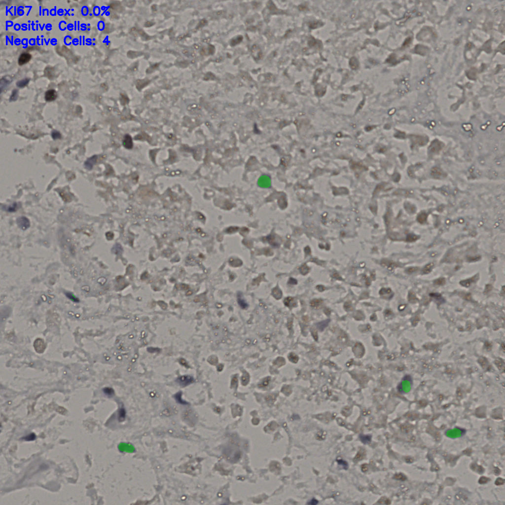 slice_15_48_x13440_y43008.png