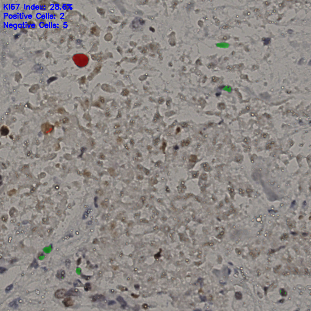 slice_15_50_x13440_y44800.png
