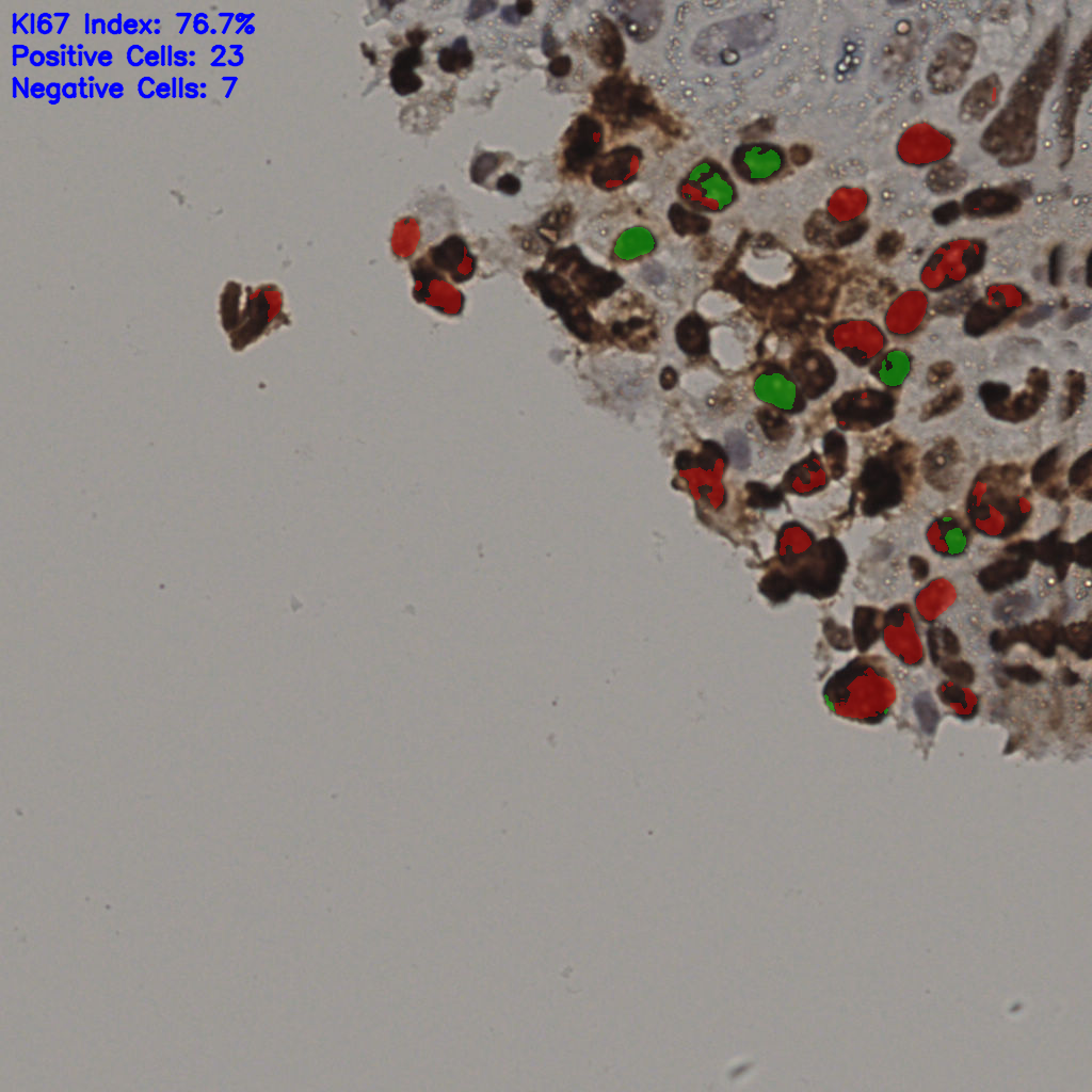slice_15_56_x13440_y50176.png