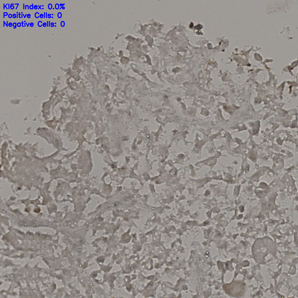 slice_16_38_x14336_y34048.png