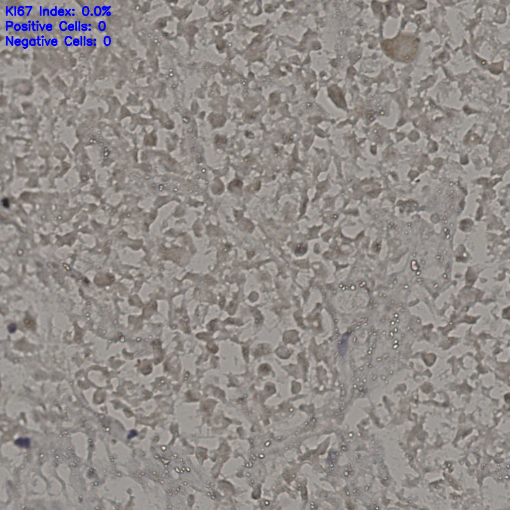 slice_16_39_x14336_y34944.png