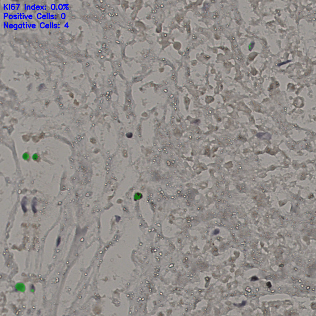 slice_16_40_x14336_y35840.png