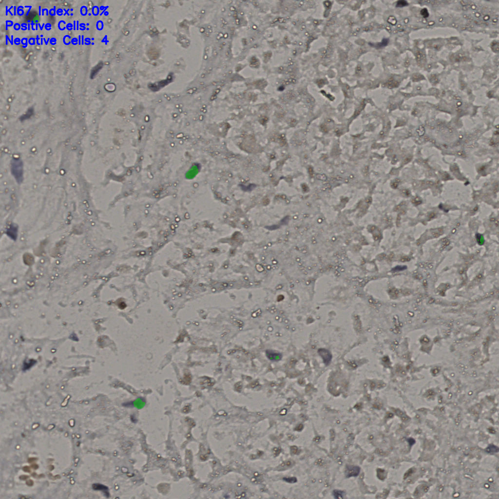 slice_16_41_x14336_y36736.png