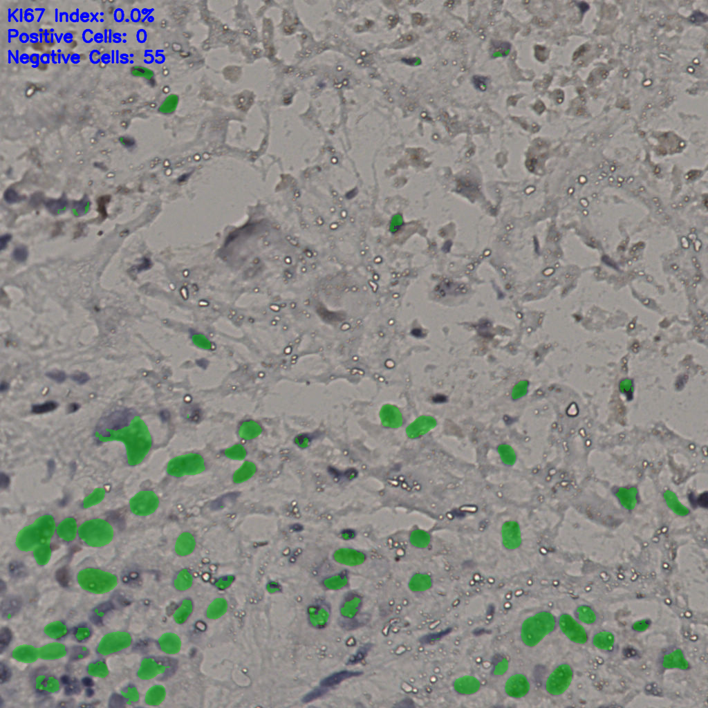 slice_16_42_x14336_y37632.png