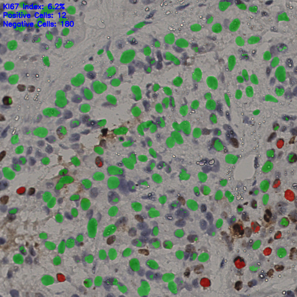 slice_16_43_x14336_y38528.png