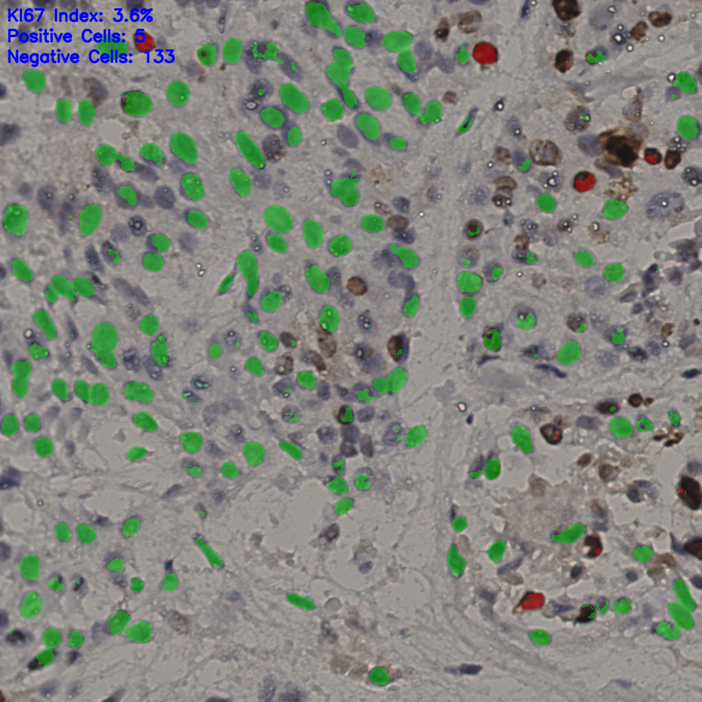 slice_16_44_x14336_y39424.png