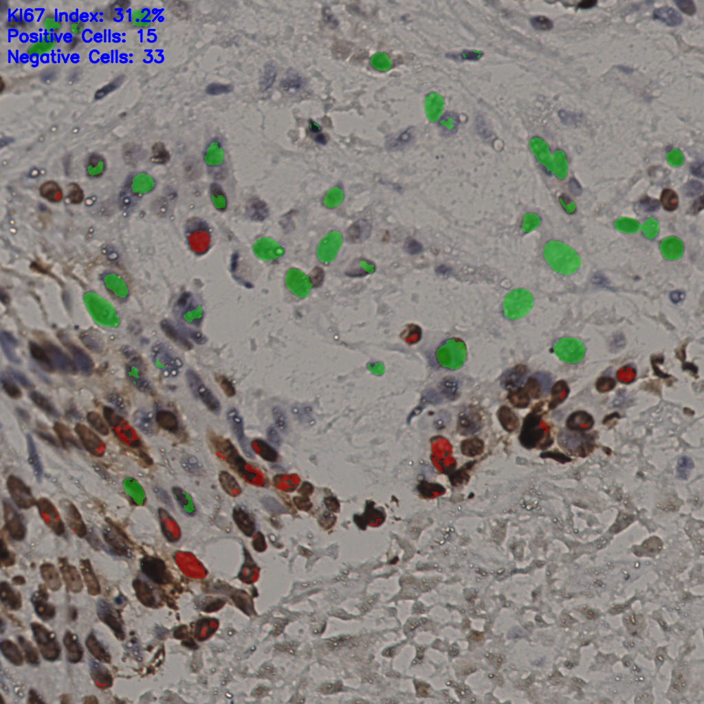 slice_16_45_x14336_y40320.png