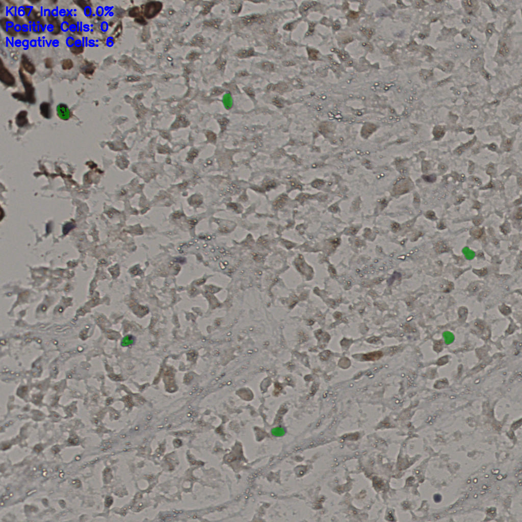 slice_16_46_x14336_y41216.png