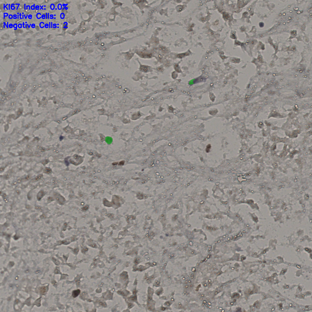 slice_16_47_x14336_y42112.png