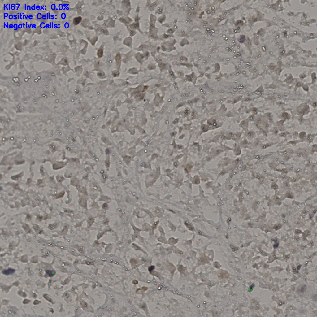 slice_16_48_x14336_y43008.png