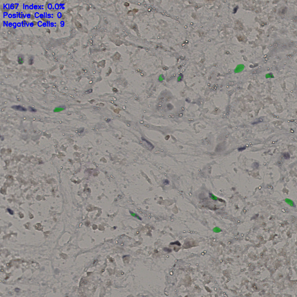 slice_16_49_x14336_y43904.png
