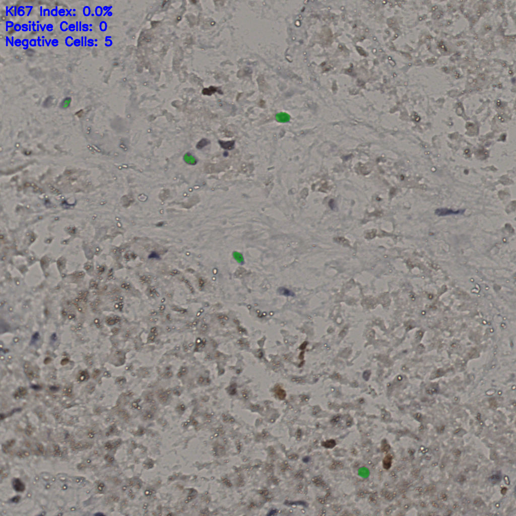 slice_16_50_x14336_y44800.png