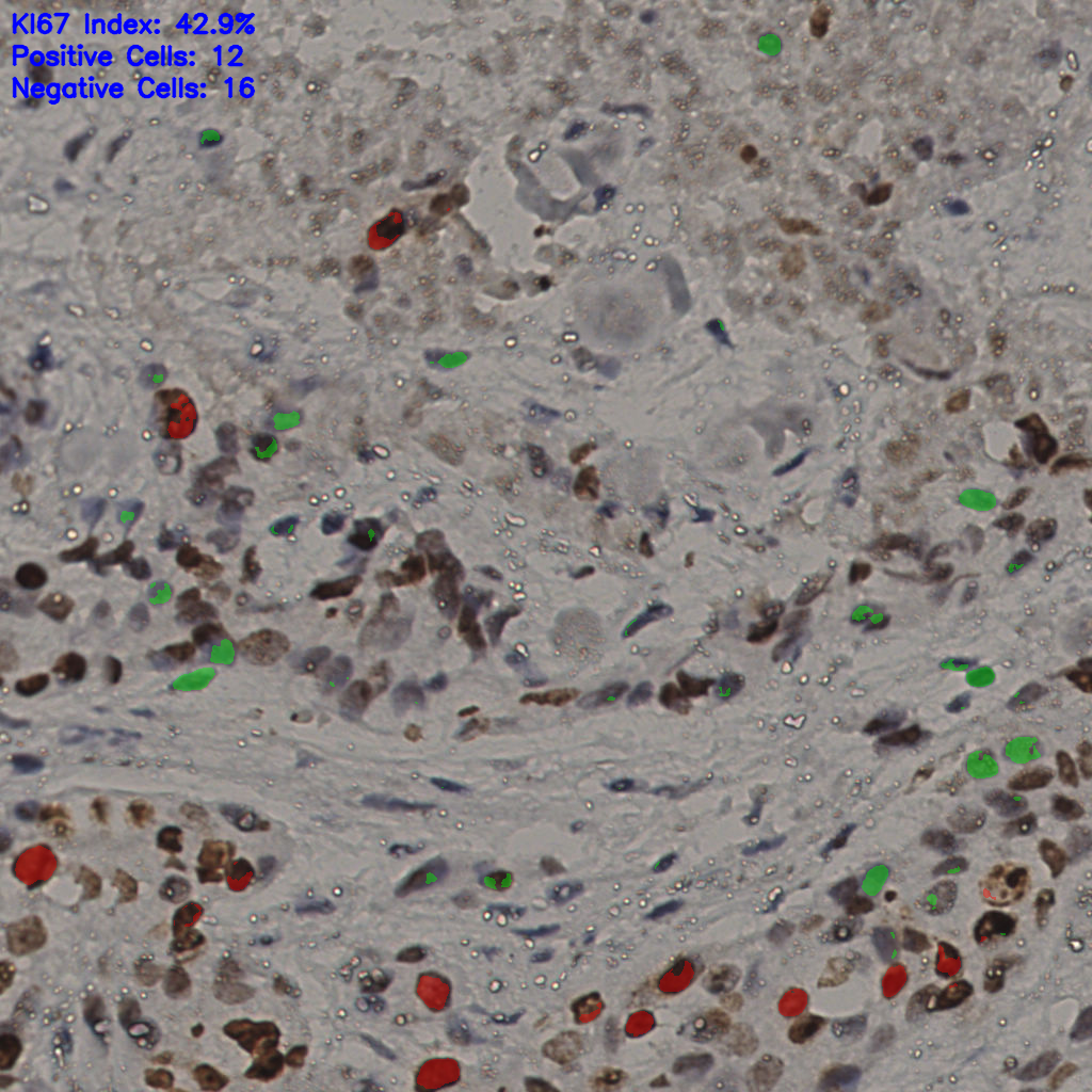 slice_16_51_x14336_y45696.png