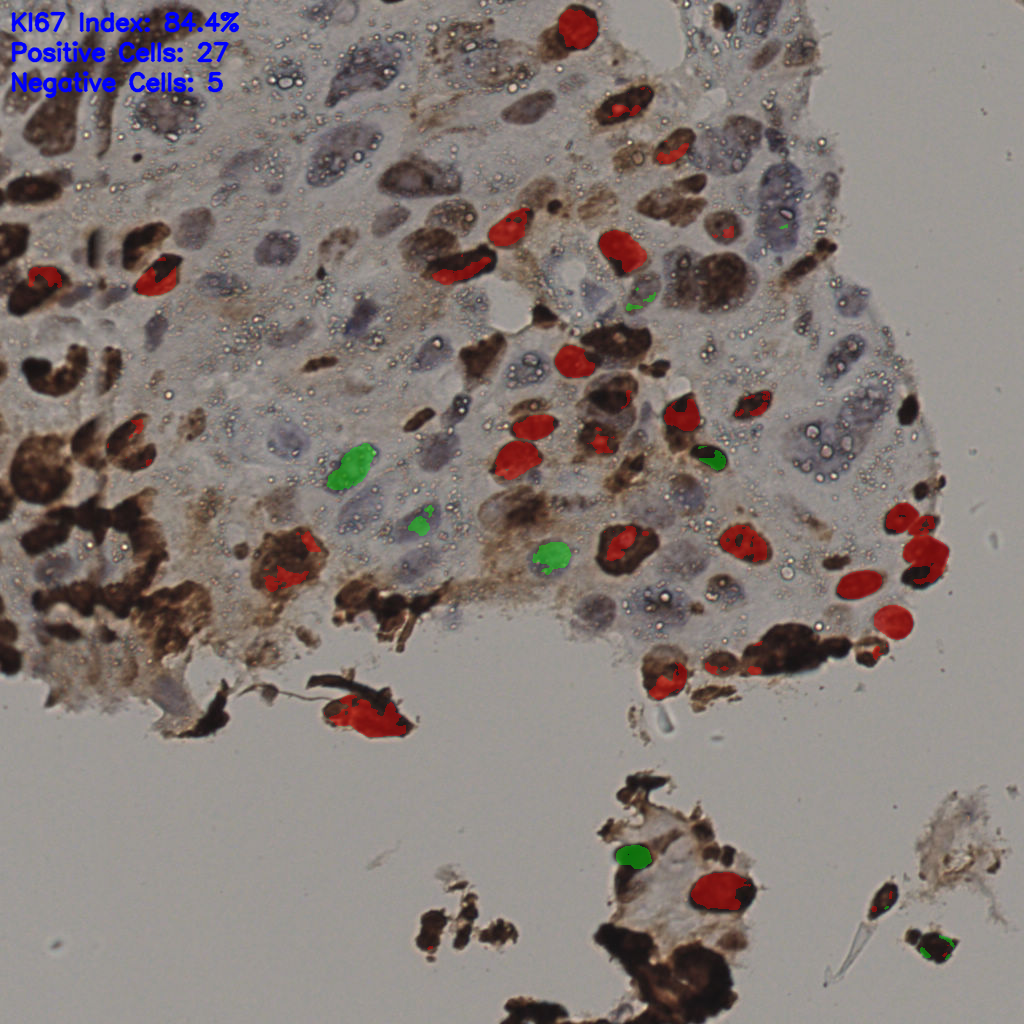slice_16_56_x14336_y50176.png