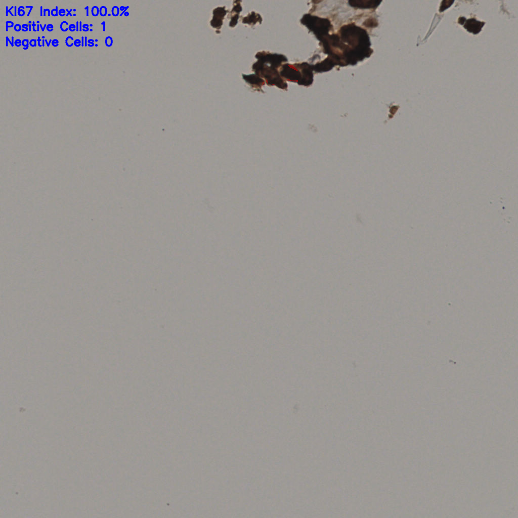 slice_16_57_x14336_y51072.png