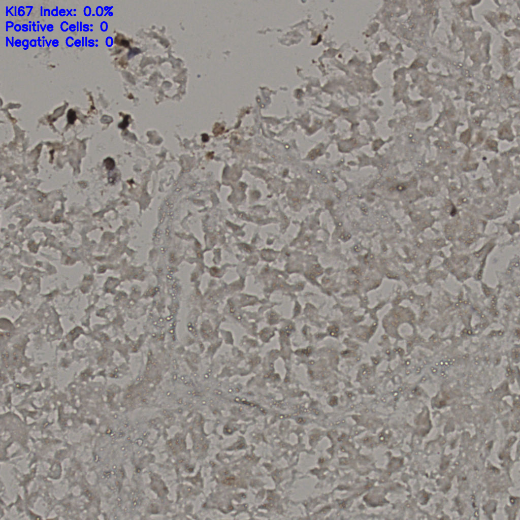 slice_17_38_x15232_y34048.png