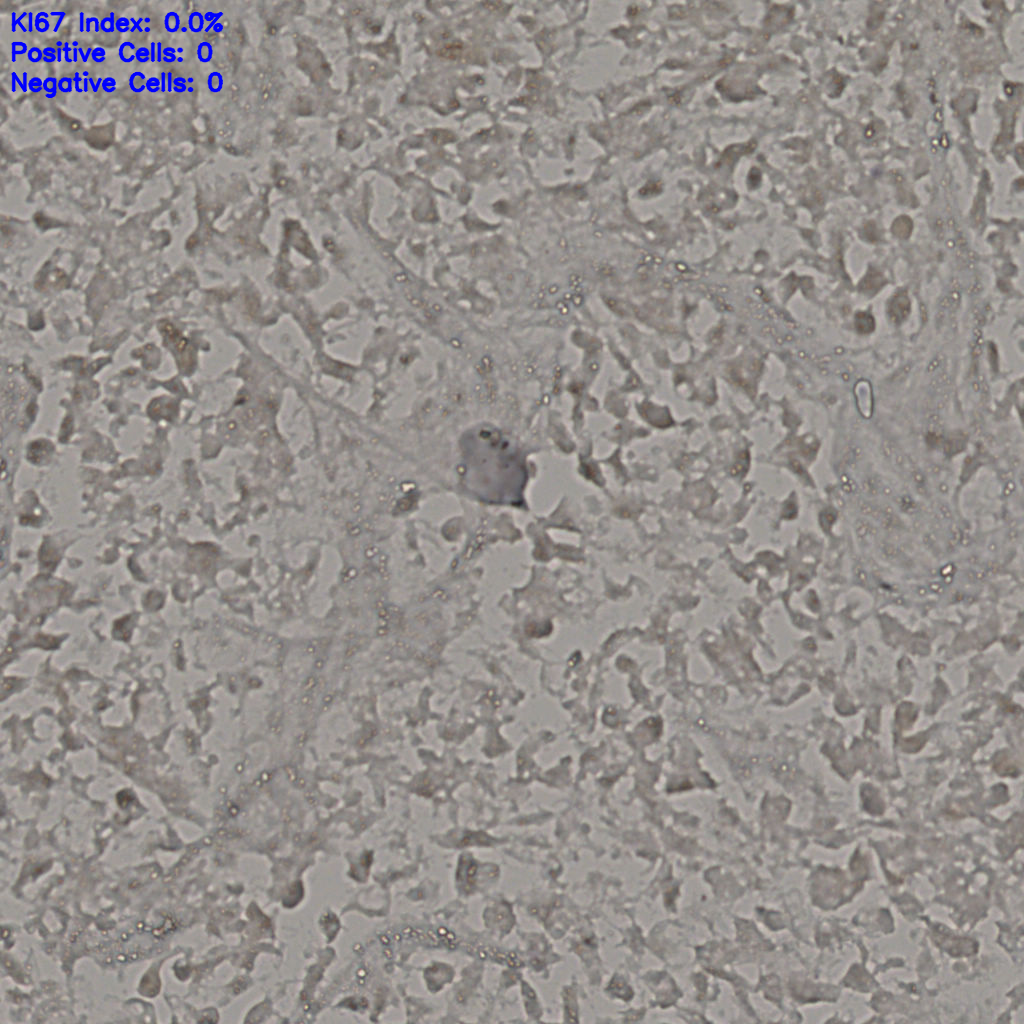 slice_17_39_x15232_y34944.png
