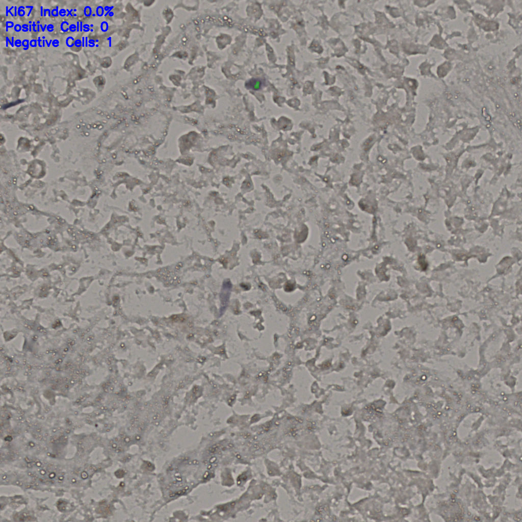 slice_17_40_x15232_y35840.png