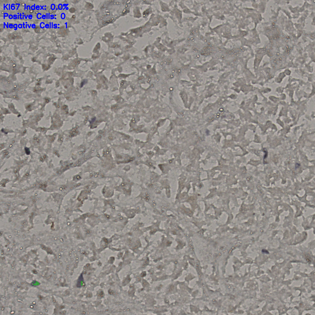 slice_17_41_x15232_y36736.png