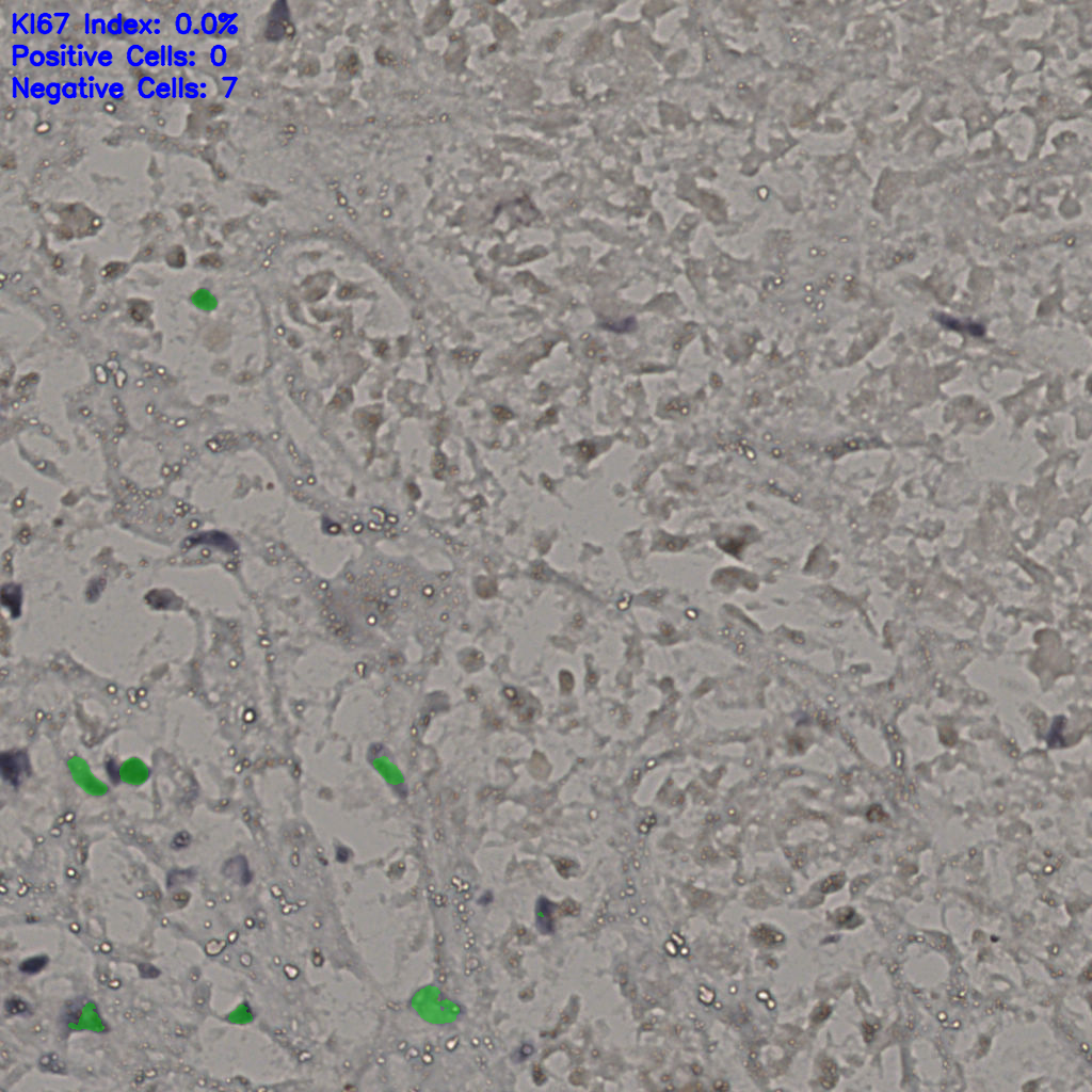 slice_17_42_x15232_y37632.png