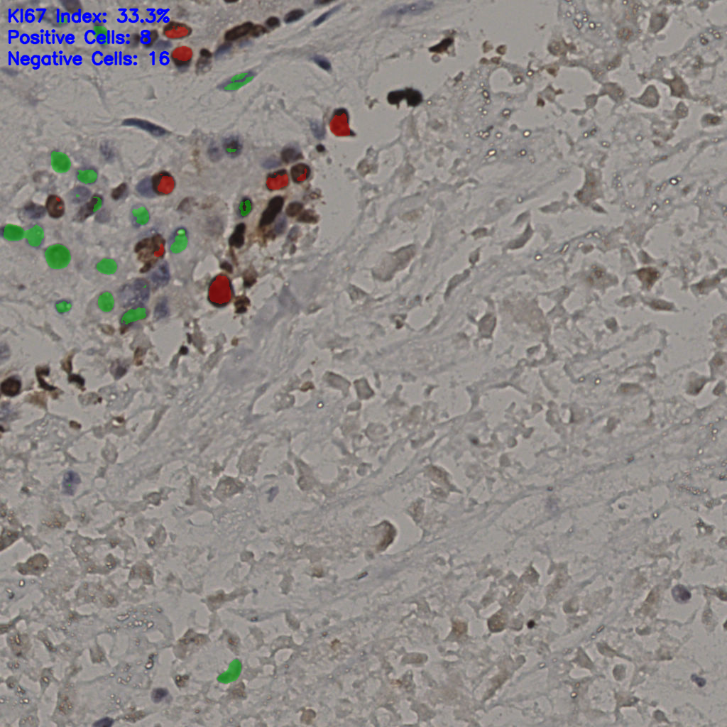 slice_17_45_x15232_y40320.png