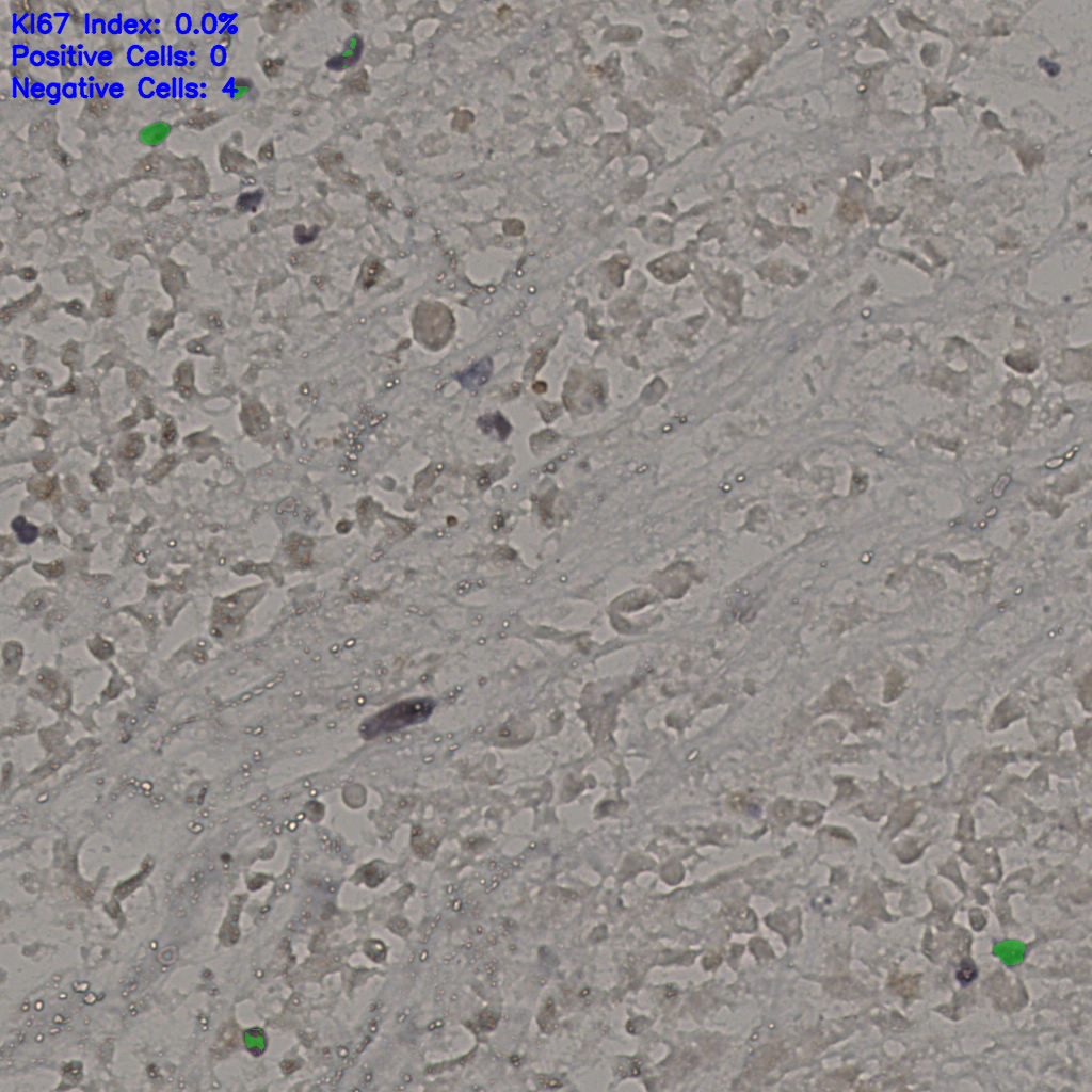 slice_17_46_x15232_y41216.png