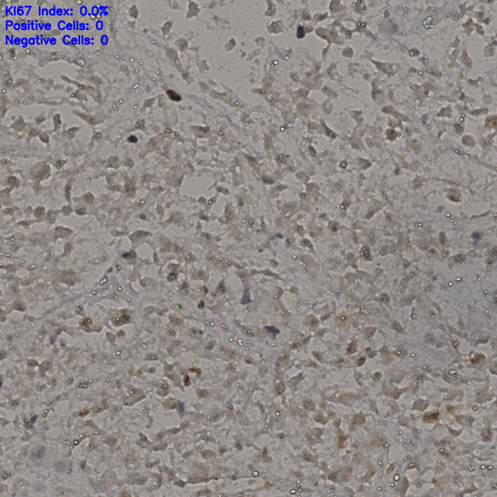 slice_17_48_x15232_y43008.png