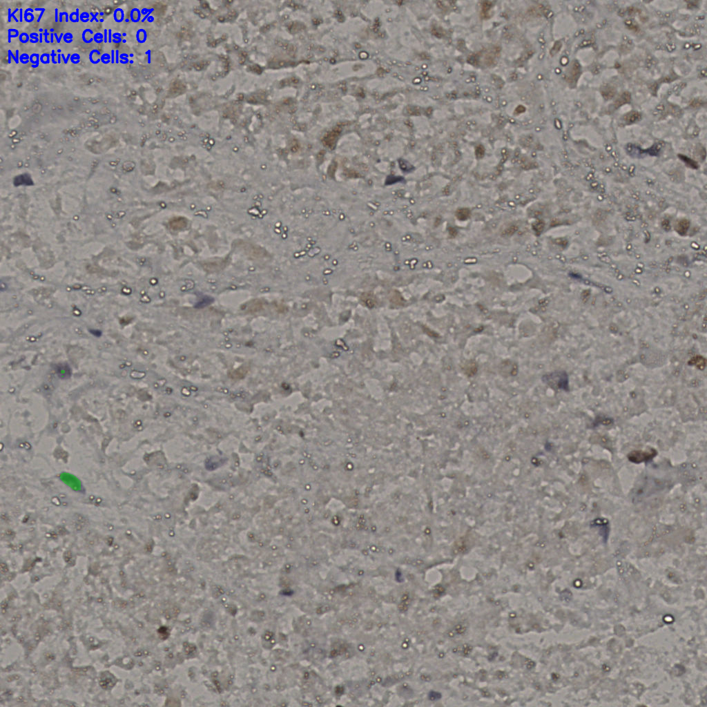 slice_17_49_x15232_y43904.png