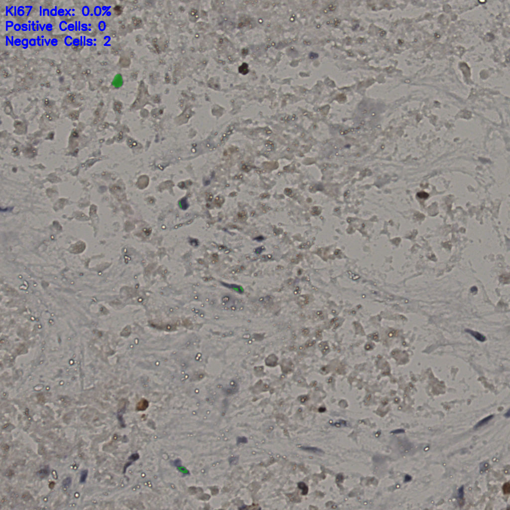 slice_17_50_x15232_y44800.png